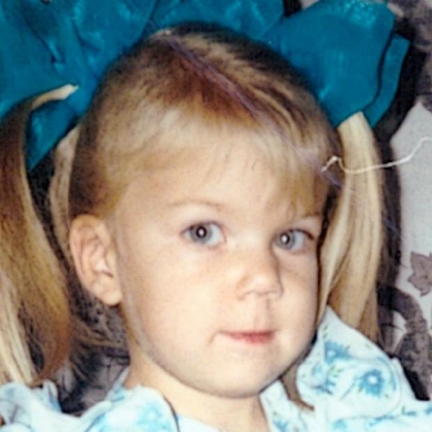 Фоторафия донора CMP-DO-3100